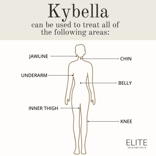 Did you know Kybella can be used to eliminate unwanted fat in all of these areas (not just jawline and chin)?? ⁣
If you haven't heard of Kybella yet, it is a non surgical treatment that targets stubborn pockets of fat. Whether the fat is due to genetics, weight gain, the aging process, or a combination, kybella offers effective and long-lasting improvement. 

The benefits of Kybella are seen gradually across four to six weeks post-treatment. Most clients do anywhere between 2 and 5 treatments (spaced 1 month apart) to achieve their desired permanent results. 

To find out more about Kybella and if it's right for you:
Call or text us!
212.647.1930

#kybella#kybellanyc#nycbotox#nycfiller#nycinjector#nycsculptra#results#fatburning#liposuction#weightloss
