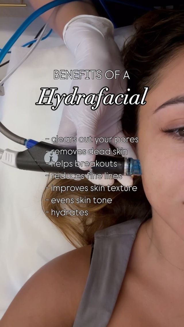 If you haven’t experienced a Hydrafacial yet, what are you waiting for? Elevate your skin with one of our most popular services!

Benefits of Hydrafacial:
🧖‍♀️ clears out the dirt and gunk in your pores
🧖‍♀️ removes dead skin
🧖‍♀️ helps with breakouts and acne
🧖‍♀️ reduces fine lines and wrinkles 
🧖‍♀️ improves skin texture 
🧖‍♀️ evens skin tone
🧖‍♀️ hydrate hydrate hydrate 
+ it’s very relaxing!

Treat yourself to a Hydrafacial at Elite today! 

#hydrafacial #skincare #facialtreatment