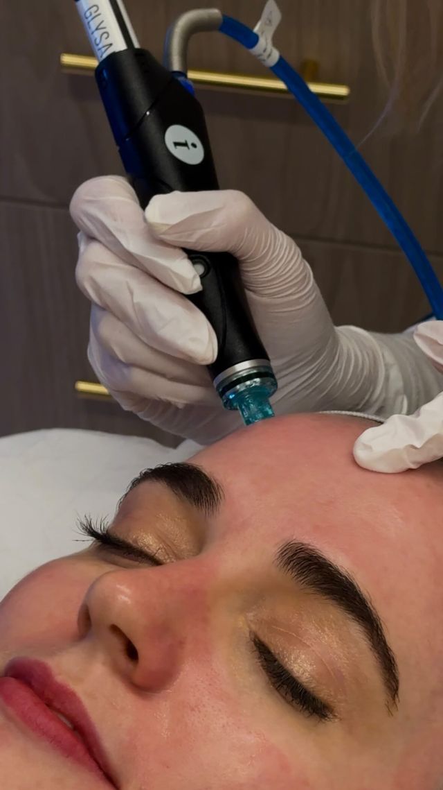 Unlock your glow with a @hydrafacial 🧖‍♀️ Cleanse, exfoliate, and hydrate during our ultimate facial experience! 

Customized to your skincare wants and needs, a Hydrafacial is the perfect way to revive your skin and experience instant radiance ✨

Ready to transform your skin? Book with @camillemckeern online or call/text 212-647-1930

#hydrafacial #facialtreatment #skinhydration #nycfacials #skingoals