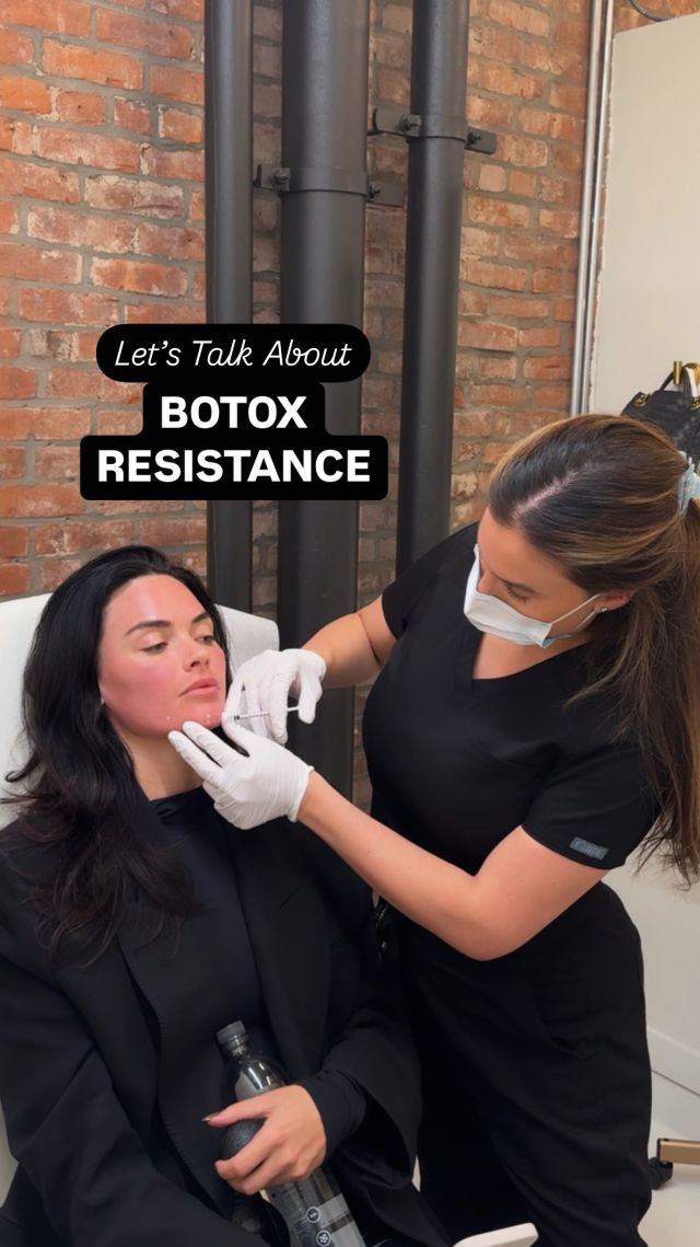 Why we DO NOT recommend getting botox sooner than every 3 months: BOTOX RESISTANCE. 

If botox is administered too frequently, your body may develop antibodies against the toxin, making the treatment less effective or shorter lasting. By sticking to an interval of at least 3 months in between injections, you allow your body to clear the toxin and minimize this risk. 

This applies to all parts of the body - which is why we recommend getting all botox treatments done at the same appointment!

How many months has it been since your last tox?! Book your next appointment online or call/text 212-647-1930. 

#botoxresults #botoxinjections #nycmedspa