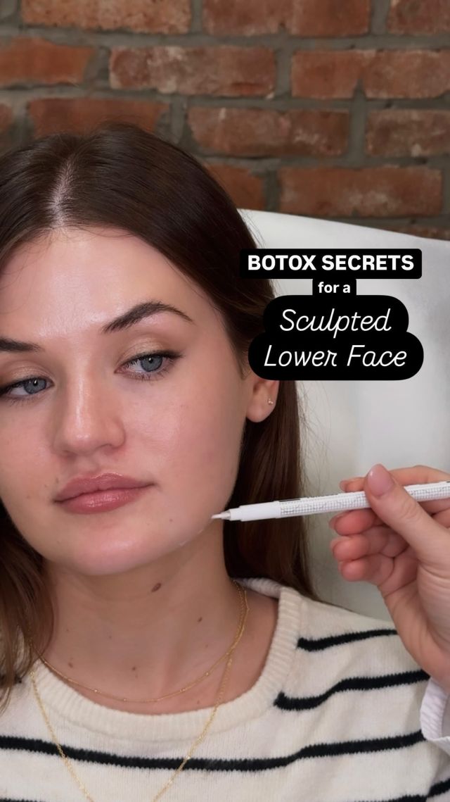 Our Elite injector @smoothliftplump reveals her secret to smoothing and sculpting the lower face… BOTOX ✨

The 3 areas of the lower face that are often overlooked that we love treating with botox is the DAOs (the Depressor Anguli Orischin), the chin and the jawline.

Book an appointment with Isis to learn more about lower face botox and explore what options are right for you 🥰 

#botoxinjections #daos #smoothskin #nycmedspa