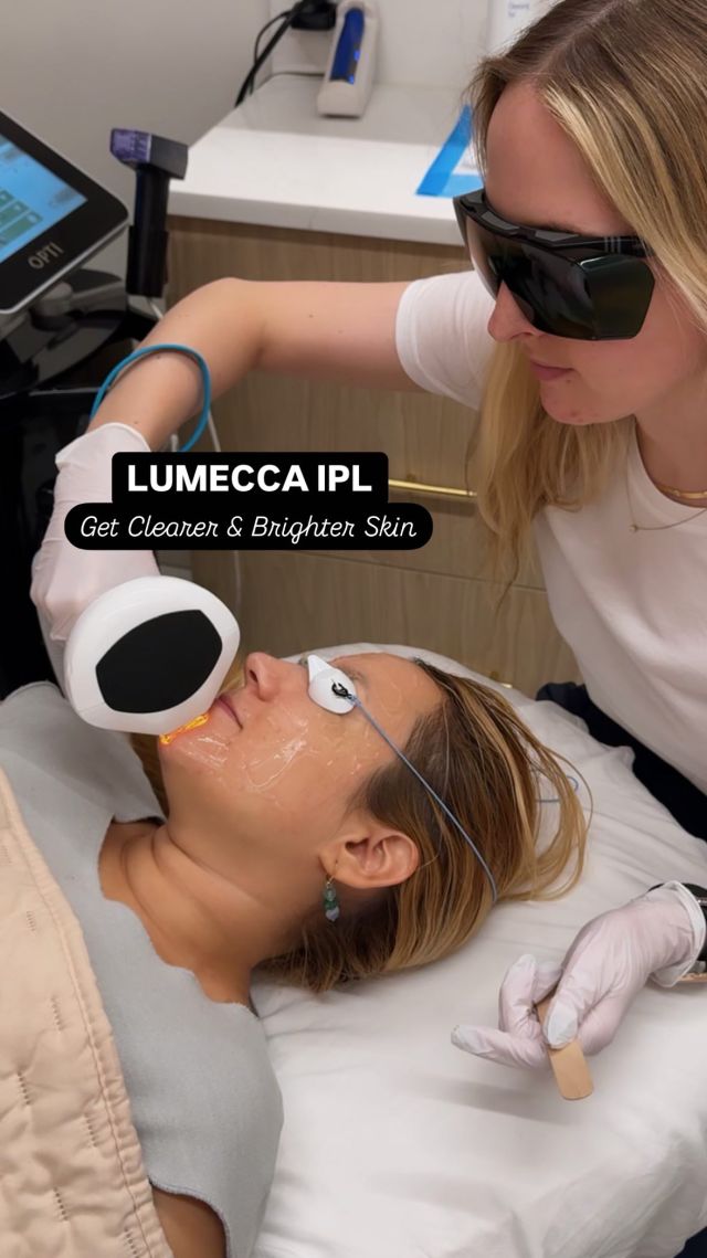 Get clearer, smoother and brighter skin with Lumecca IPL treatment!

Lumecca IPL by @inmodeaesthetics is a non-invasive treatment that uses high intensity light to target pigmentation and discoloration to improve skin texture and tone.

This is a great option for those seeking a quick, effective, and safe solution for dark spots, hyperpigmentation, rosacea, spider veins, and other concerns with minimal recovery time.

Ready to transform your skin? Book a Lumecca IPL treatment with @camillemckeern online or call/text 212-647-1930!

#lumeccaipl #laserfacial #skintreatment #skincare #facialtreatment #skinimprovement #nycmedspa