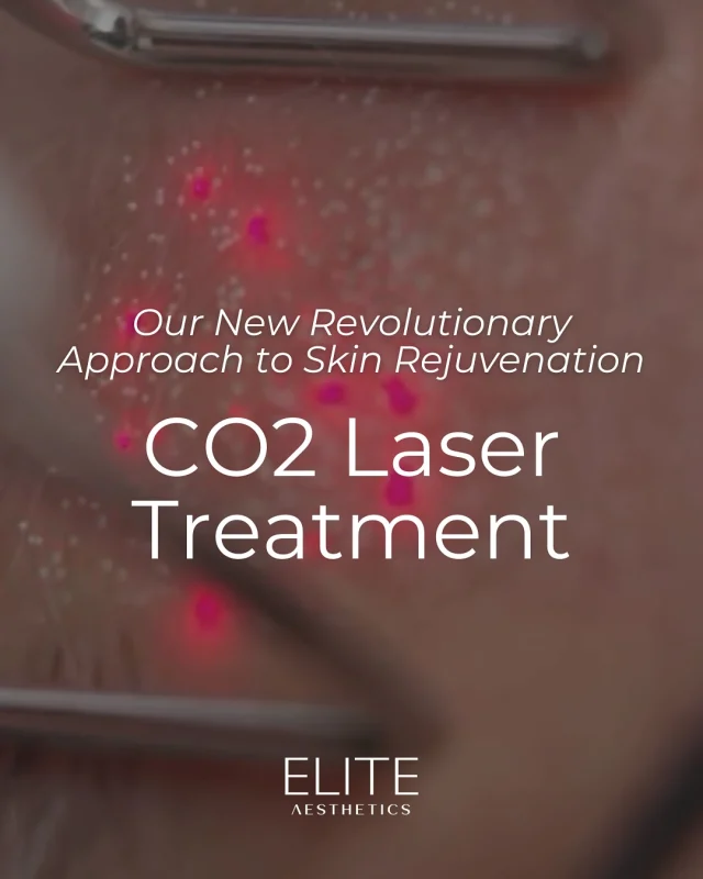 Introducing our most cutting-edge treatment yet… CO2 laser! The first of it’s kind in NYC 🌟 Swipe to learn more about what we’re offering ➡️

This powerful treatment provides remarkable skin rejuvenation benefits including collagen stimulation, youthful-looking skin, improved skin elasticity, reduced skin damage and more. PLUS - it’s fully customizable with different levels of intensity that are tailored to your wants and needs with minimal downtime ✨

Ready to experience this advanced #skintreatment? Call or text 212-647-1930 to book your appointment!

#co2laser #co2laserresurfacing #lasertreatment #skinrejuvenation #skincaresolutions #nycmedspa @reviveaestheticsllc